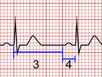 Cálculo de Frecuencia Cardiaca