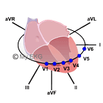 Correlación de las Paredes Cardiacas y las Derivaciones del EKG