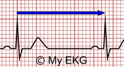 heart rate ekg strip count rhythm calculate square calculating bpm determine lpm