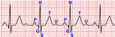 Ondas del Electrocardiograma