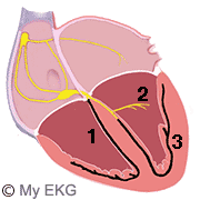 Posterior Bifascicular Block