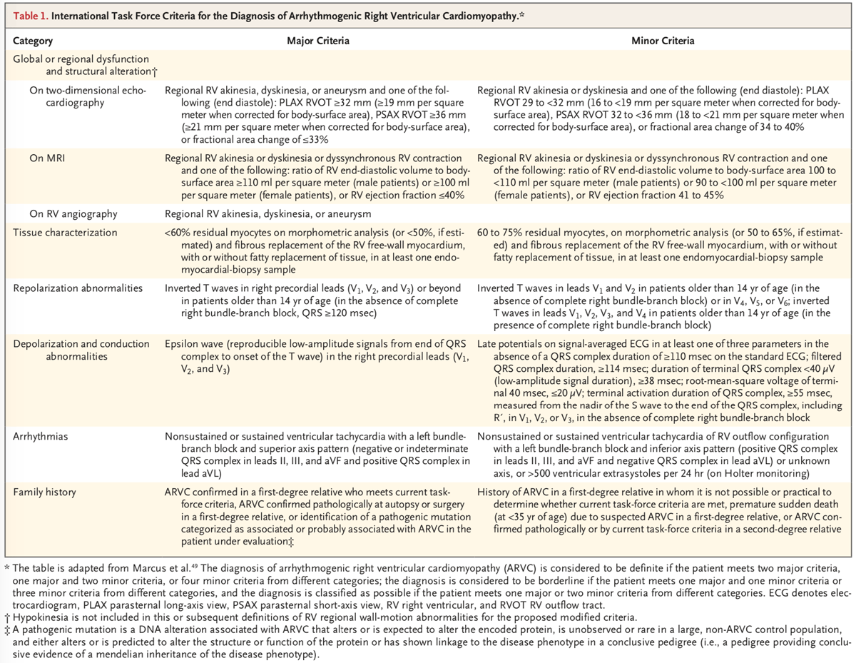 Critérios de Cardiomiopatia Arritmogênica do Ventrículo Direito no ECG