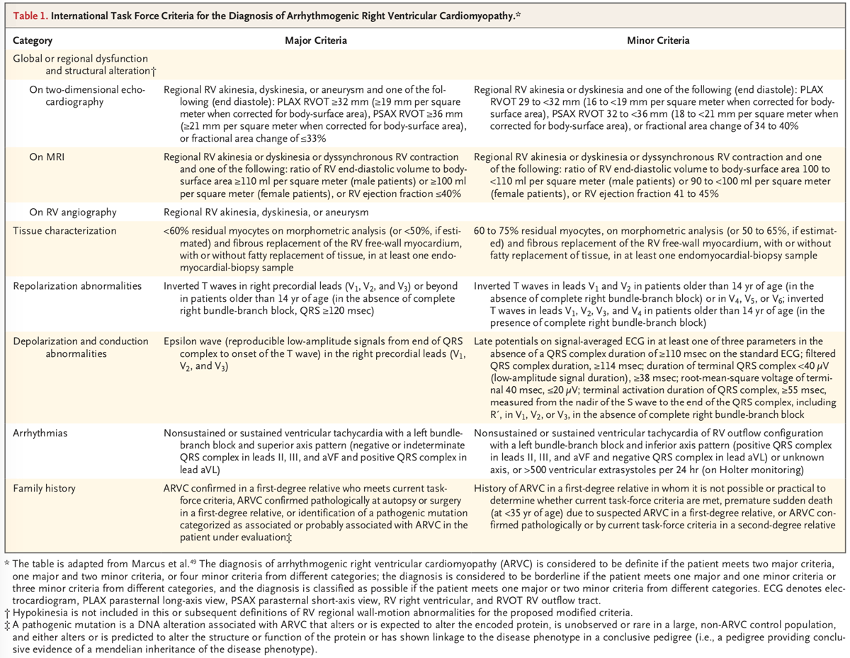 Criterios de Miocardiopatía Arritmogénica del Ventrículo Derecho