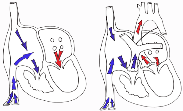 Circulación postnatal