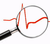 How to Read and Report an Electrocardiogram. Guide to read Electrocardiograms