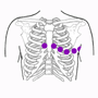 Placement of Electrodes of the Electrocardiogram