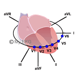 Correlation between Heart Walls and EKG Leads