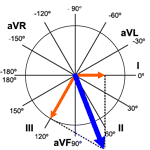 Heart Axis Calculation