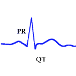 Intervalos PR y QT 