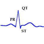 Intervalos y Segmentos del Electrocardiograma