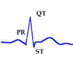 Intervals and Segments of the Electrocardiogram