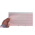 Cómo Realizar correctamente un Electrocardiograma