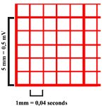 Electrocardiogram Paper