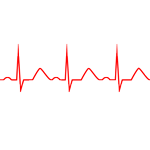 Heart Rhythm Analysis