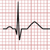 QRS Complex Morphology in the Electrocardiogram