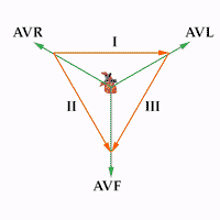 Derivazioni periferiche dell'elettrocardiogramma