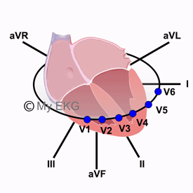 Correlation between Heart Walls and Electrocardiogram Leads