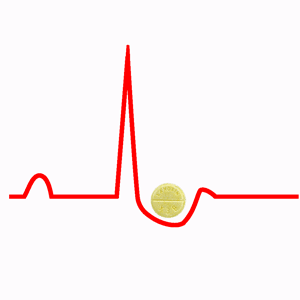 Digoxina y Electrocardiograma