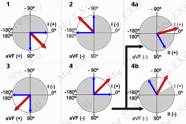 Cardiac Axis Chart