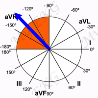 Extreme Axis Deviation