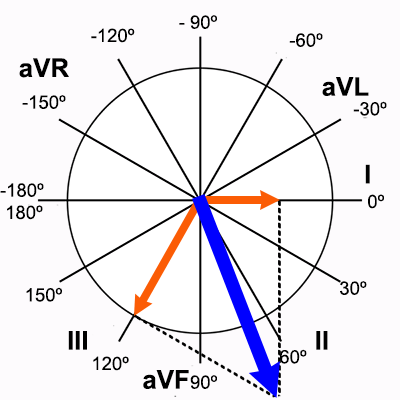 Calcul exact de l'axe du cœur