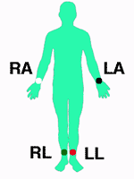 Limb Electrodes of the AHA Electrode Colour Coding