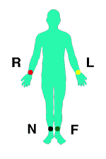 Électrodes périphériques, Astuce de les électrodes de l'électrocardiogramme