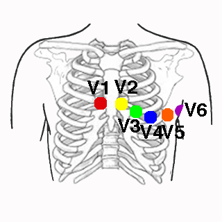 ecg verem a fogyáshoz)