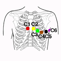 Electrodos Precordiales del Código de Colores de la IEC