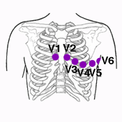 Generalidades del Electrocardiograma