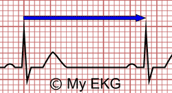 Cálculo de Frecuencia Cardiaca en ritmo regular