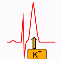 Hyperkaliémie et électrocardiogramme