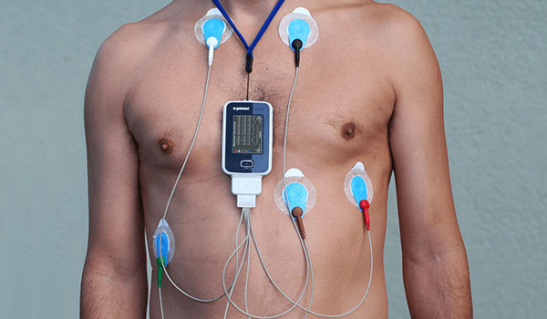 Holter EKG