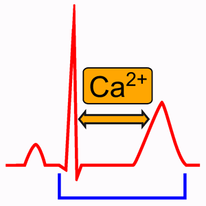 Hipocalcemia y Electrocardiograma