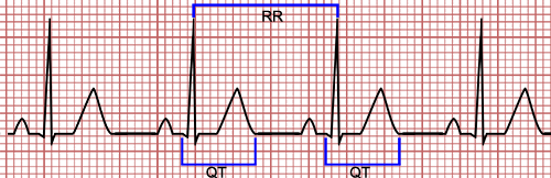 Corrected QT Interval Calculator