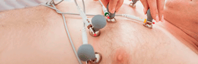 Électrodes de l'électrocardiogramme