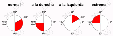 Cálculo del Eje Cardiaco