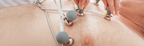 EKG Electrodes Placement