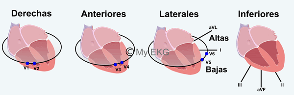 Corrélation entre les dérivations et les parois cardiaques