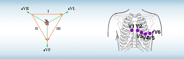 Dérivations de l'ECG