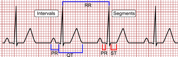 Intervalli e segmenti dell'ECG