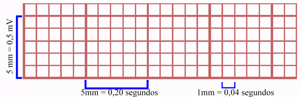 Características do Papel do ECG