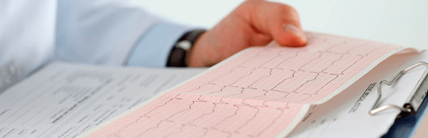 ¿Qué es el Electrocardiograma?