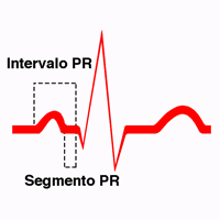 Diferencias entre segmentos e intervalos electrocardiográficos