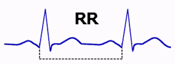 Intervalle RR