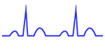 Pacing inhibited by sensed spontaneous cardiac depolarizations