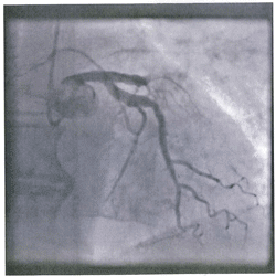 Segunda Imagen de Cardiología del Examen MIR 2016