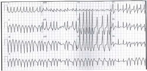 Primera Imagen de Cardiología del Examen MIR