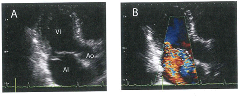 Tercera Imagen de Cardiología del Examen MIR 2017