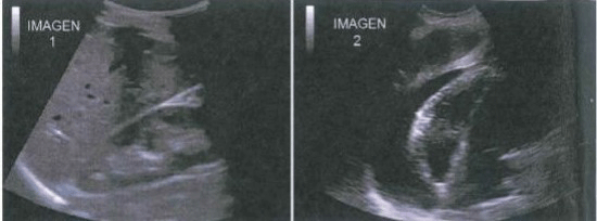 Tercera Imagen de Cardiología del Examen MIR 2018